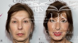Видеоурок "Возрастной макияж с лифтинг-эффектом"